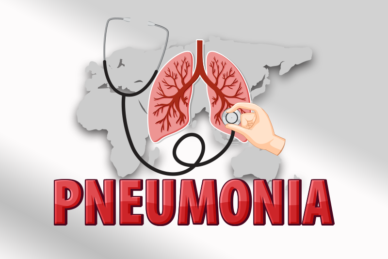 ICD-10 Codes to Report Pneumonia